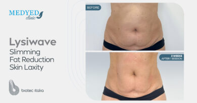عيادة Medyed تجربة شاملة للعلاجات التجميلية والعافية المتقدمة